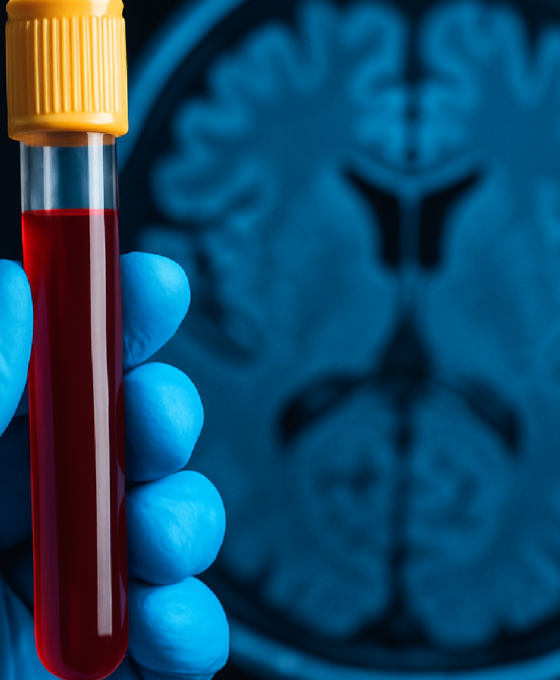 Imagem ilustrativa sobre Em estudo, exame de sangue revela sinais de Alzheimer décadas antes dos sintomas